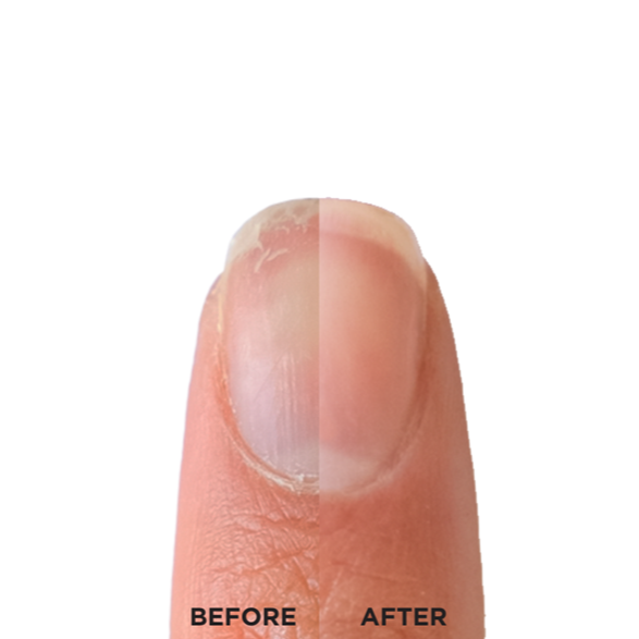 CND_Nail_Strengthener_Rxx_Vegan_Before_After