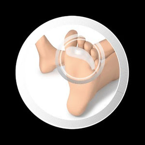 Tåledspude til hammertæer. Video der viser, hvordan aflastningen skal sættes på foden.